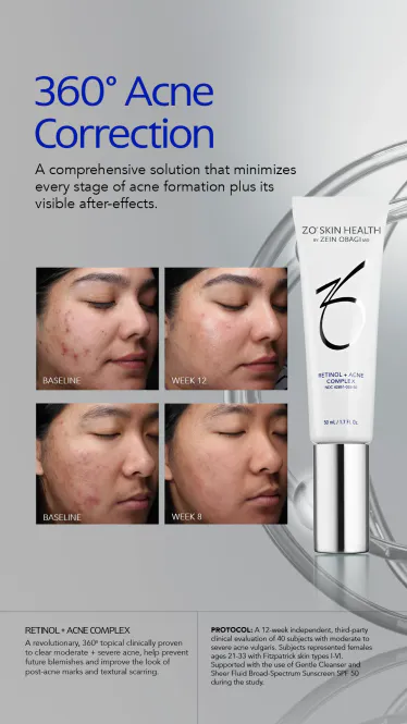 Hovedbilde ZO Retinol + Blemish Complex